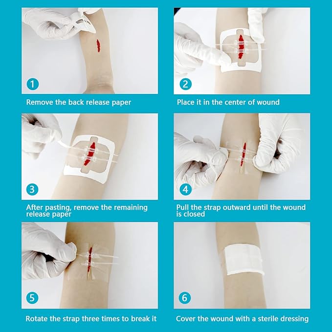 Zip Stitch Emergency Wound Closure Strips - 2Pcs Laceration Closure Kit Closures Repair Wounds Without Stitches - Butterfly Bandaids Bandages for Wounds