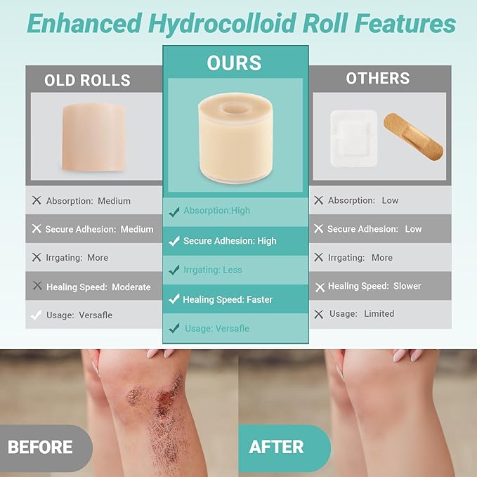 Upgraded Hydrocolloid Roll for Wound Care, 2in*16ft Hydrocolloid Patch Bandages with Self-Adhesive, Ultra Absorbent, Flexible, Waterproof, DIY Size, First Aid Kit Essential