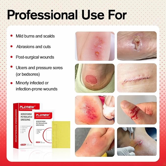 Xeroform Petrolatum Dressing 5"x9", 25 PCS Non-Adherent Gauze for Low Exudating Wounds, Fine Mesh Gauze Pads for Burns, Abrasions, Lacerations, Skin Grafts and Surgical Incisions