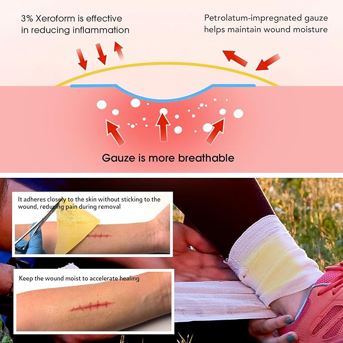 Xeroform Petrolatum Dressing 4"x4", 25 PCS Non-Adherent Gauze for Low Exudating Wounds, Fine Mesh Gauze Pads for Burns, Abrasions, Lacerations, Skin Grafts and Surgical Incisions