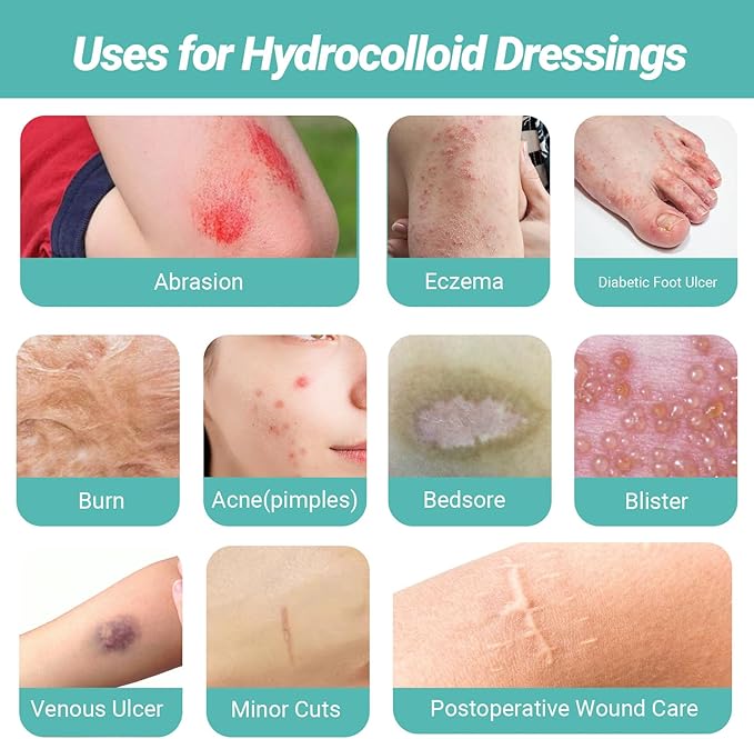 Upgraded Hydrocolloid Roll for Wound Care, 2in*16ft Hydrocolloid Patch Bandages with Self-Adhesive, Ultra Absorbent, Flexible, Waterproof, DIY Size, First Aid Kit Essential