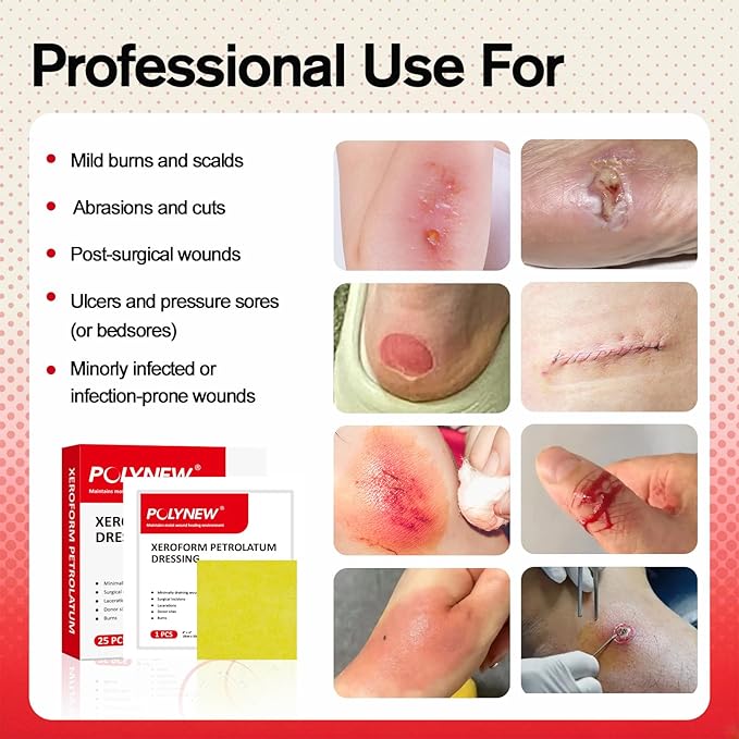 Xeroform Petrolatum Dressing 4"x4", 25 PCS Non-Adherent Gauze for Low Exudating Wounds, Fine Mesh Gauze Pads for Burns, Abrasions, Lacerations, Skin Grafts and Surgical Incisions