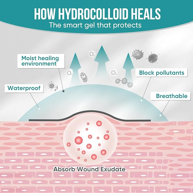 40 Pack Hydrocolloid Wound Dressing 4" x 4", Hydrocolloid Patch Bandages with Self-Adhesive, Bed Sore Bandages, Highly Absorbent for Burn, Blister, Acne Care, Sterile and Waterproof