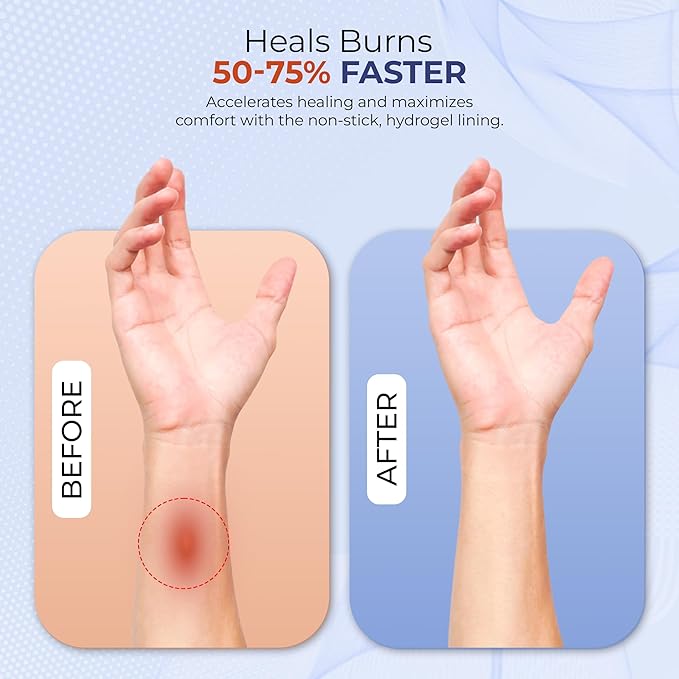 BurnFix® Hydrogel Burn Gel Packets – 3.5 g Soothing First Aid Burn Cream for Instant Cooling Relief on Minor Burns, Sunburns & Scalds │ Ideal Emergency Kit Essential (Pack of 25)