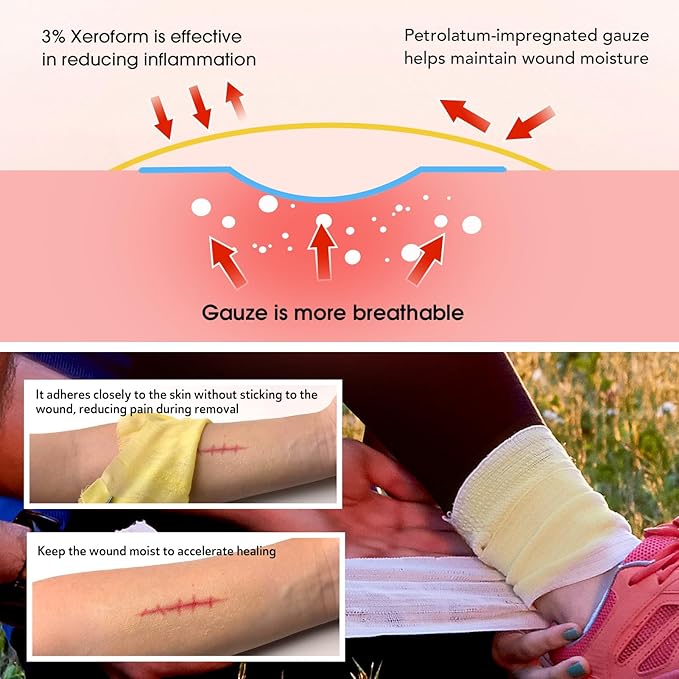 Xeroform Petrolatum Dressing 5"x9", 25 PCS Non-Adherent Gauze for Low Exudating Wounds, Fine Mesh Gauze Pads for Burns, Abrasions, Lacerations, Skin Grafts and Surgical Incisions