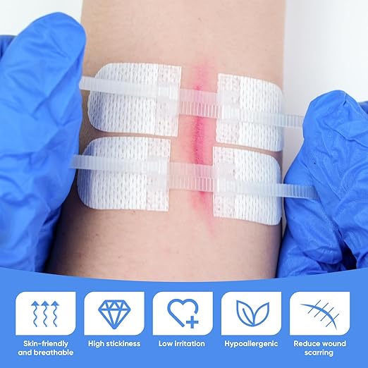34 Pack Wound Closure Strips, Zip Stitches Wound Closure Kit 6PCS Repair Wounds Without Stitches, Sutures Butterfly Bandaids for Cut Care, Skin Closures, Outdoor Survival, Trauma Care
